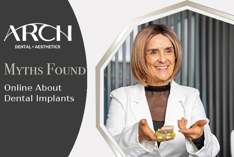 Busting Myths Found Online About Dental Implants videocard