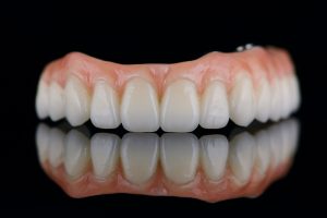 Image of a dentist smiling, pointing to a set of implant dentures in a patient's mouth, with the text "Full Mouth Implant Dentures: Are They Right For You?"